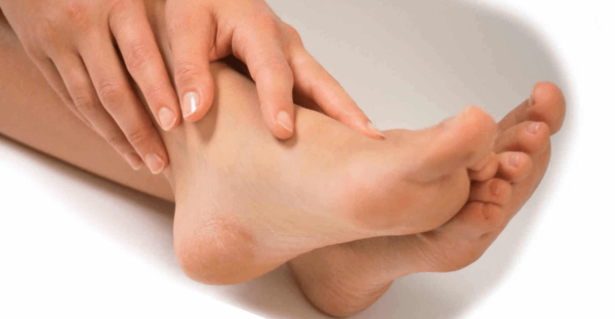 Mantar enfeksiyonu ayak parmakları arasındaki cildi etkileyebilir. 