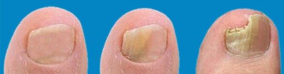 Mantar geliştirme süreci