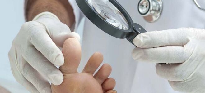 Mantar tedavisine başlamadan önce yapılan muayeneler