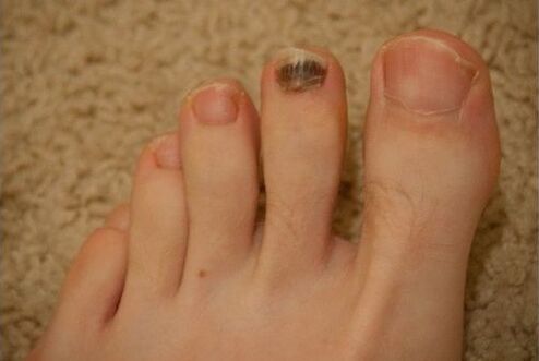 Oral ve topikal ilaçların kullanımı