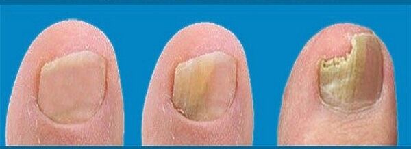 mantar gelişim süreci